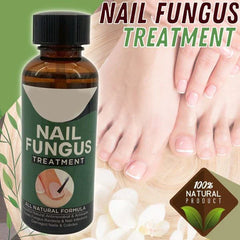 Nail Fungus Treatment